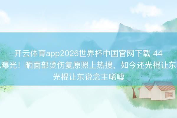 开云体育app2026世界杯中国官网下载 44岁杨蓉近况曝光！晒面部烫伤复原照上热搜，如今还光棍让东说念主唏嘘